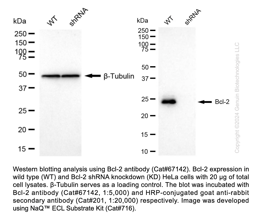 Thumbnail: KD-Validated Anti-Bcl-2 Rabbit Moclonal Ab#67142