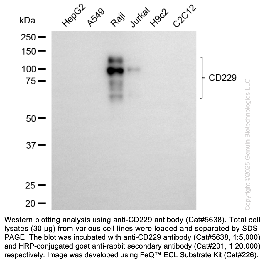 Anti-LY9 Rabbit Monoclonal Ab #5638