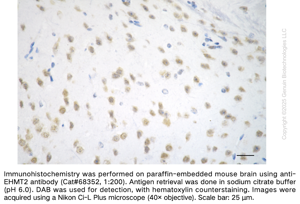 Thumbnail: KD-Validated Anti-EHMT2 Rabbit Monoclonal Ab#68352