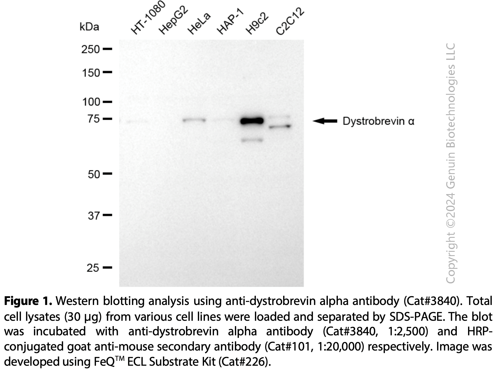 Anti-DTNA Mouse Monoclonal Ab #3840