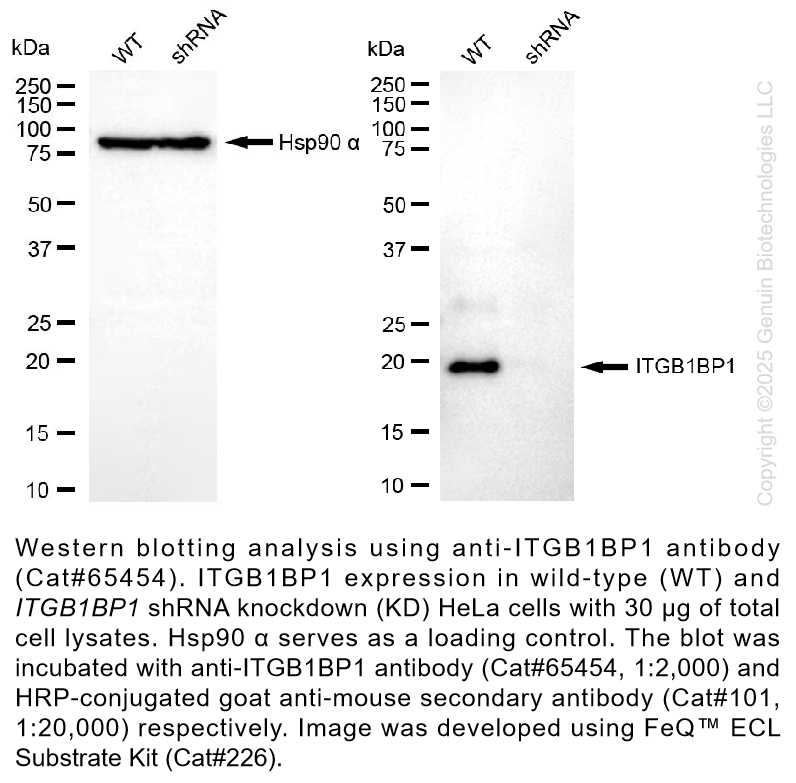 Thumbnail: KD-Validated Anti-ITGB1BP1 Mouse Oligoclonal Antibody #65454