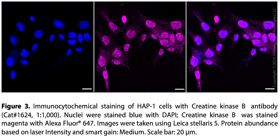 Thumbnail: Anti-Creatine kinase B Rabbit mAb #1624