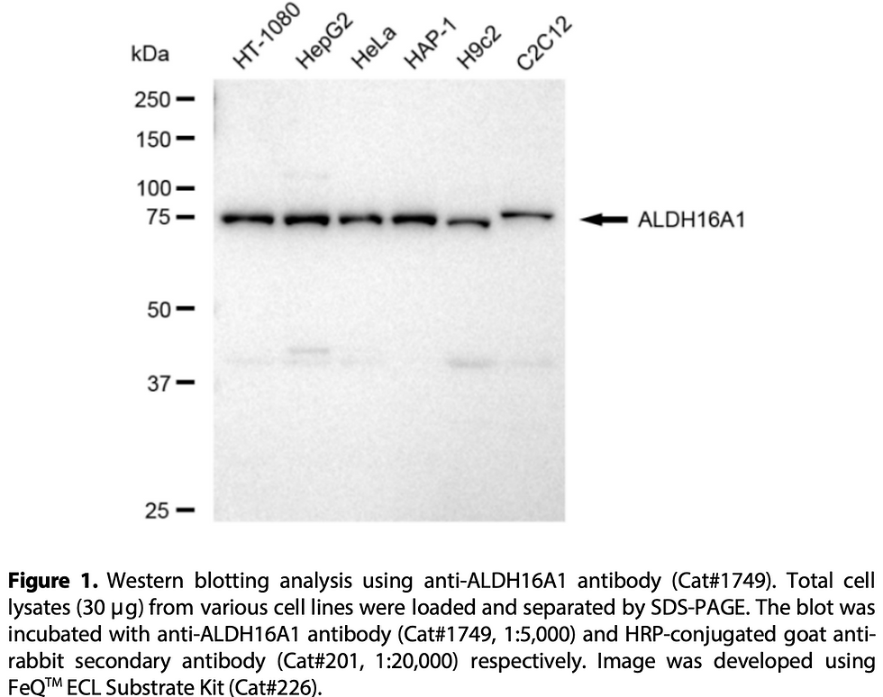Thumbnail: Anti-ALDH16A1 Rabbit mAb #1749