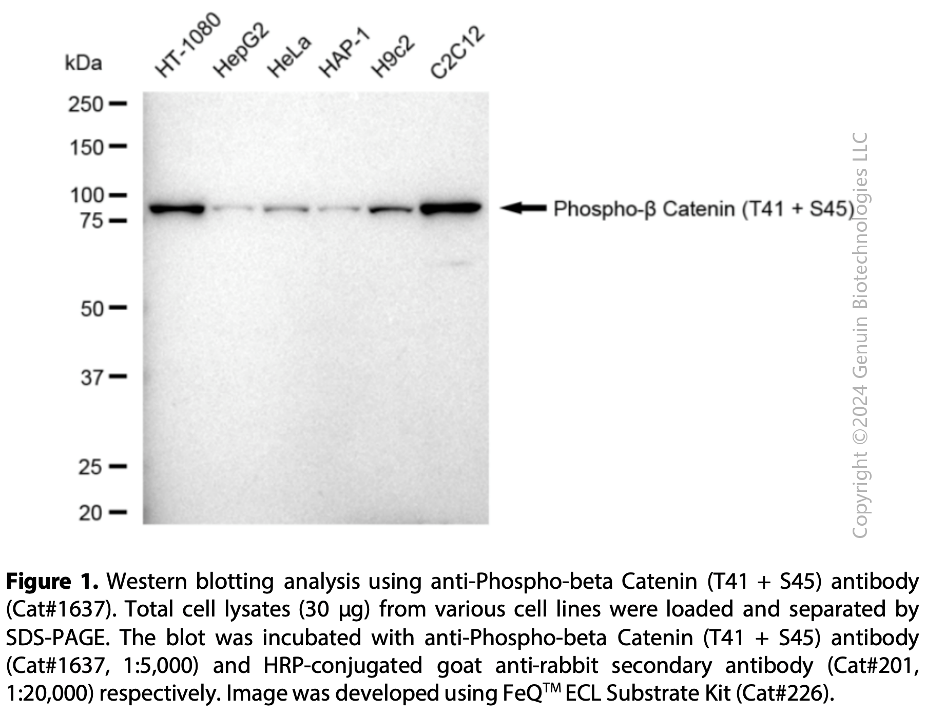 Anti-Phospho-Beta Catenin (T41 + S45) Rabbit mAb #1637