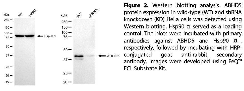 Thumbnail: WB-Validated ABHD5 Lentiviral shRNA Knockdown Kit #V61417