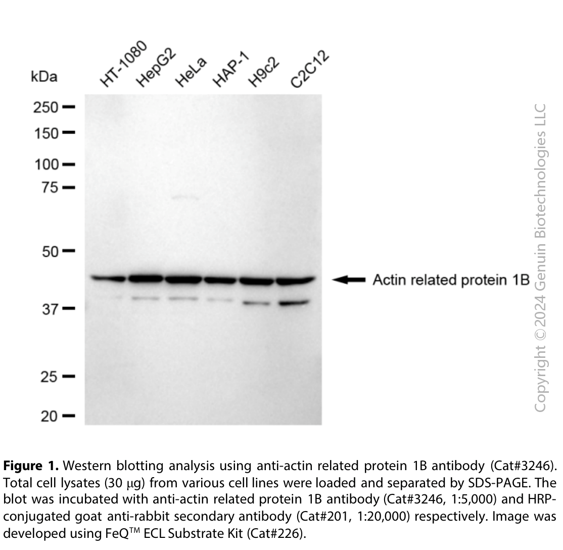 Anti-Actin Related Protein 1B Rabbit Monoclonal Ab#3246