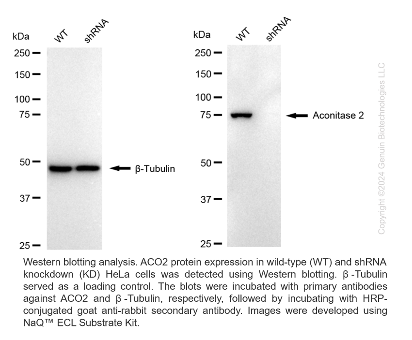 WB-Validated ACO2 Lentiviral shRNA Knockdown Kit #V66152