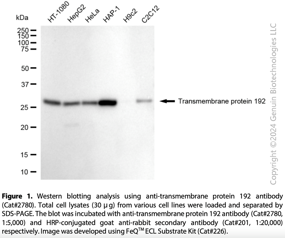 Thumbnail: Anti-Transmembrane Protein 192 Rabbit mAb #2780