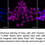 Thumbnail: KD-Validated Anti-Stromal Interaction Molecule 1 Rabbit Monoclonal Ab#61517