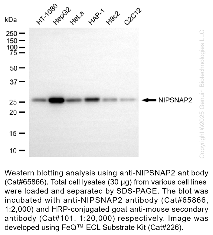 KD-Validated Anti-NIPSNAP2 Mouse Monoclonal ab #65866