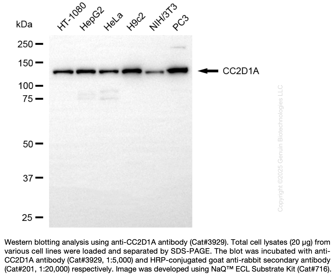 Anti-CC2D1A Rabbit Monoclonal Ab #3929