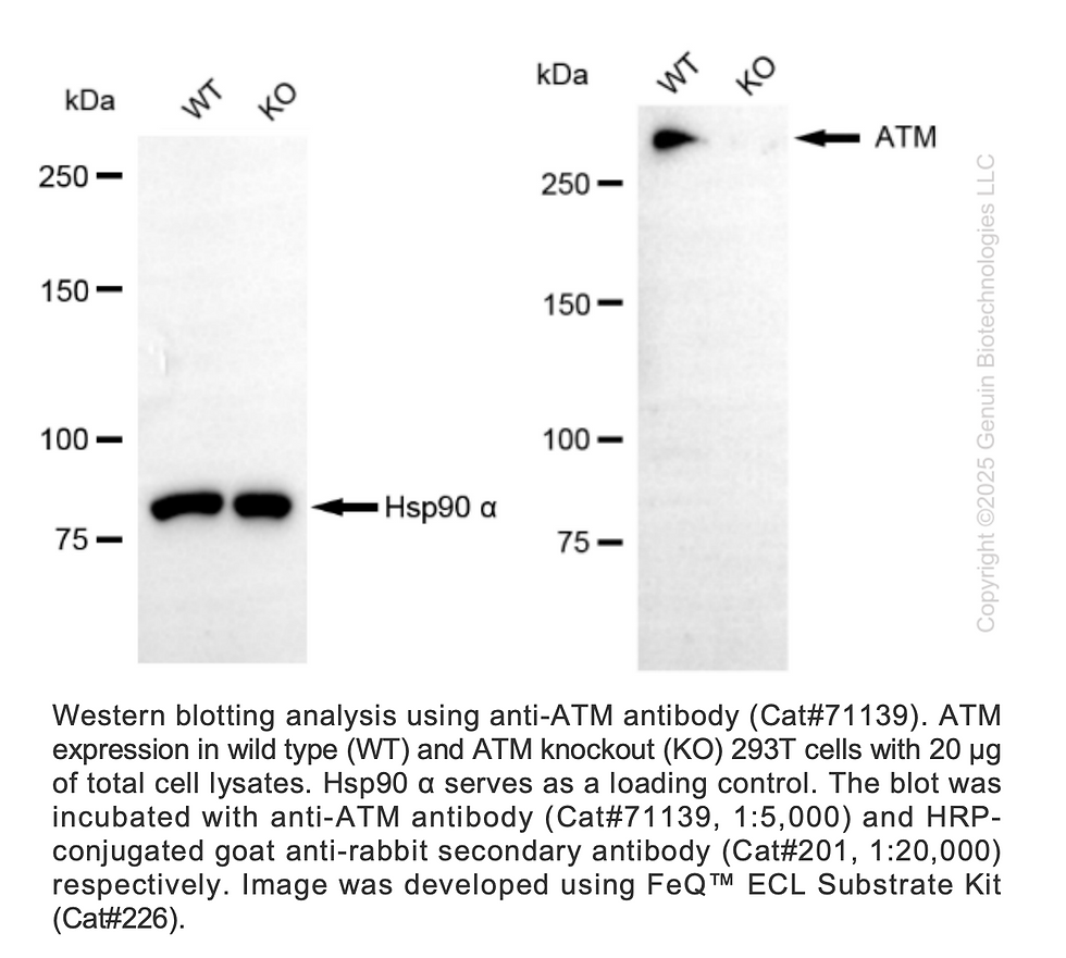 Texas Atm Rabbit KO-Validated Anti-ATM Rabbit Monoclonal Ab #71139 | GenuIN Biotech