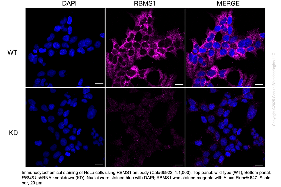 Thumbnail: KD-Validated Anti-RBMS1 Mouse Monoclonal ab #65922