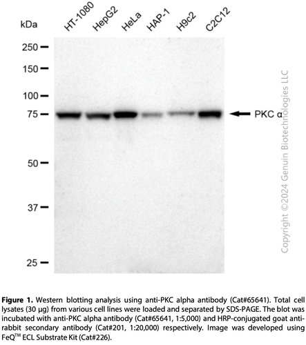 KD-Validated Anti-PKC Alpha Rabbit Monoclonal Ab#65641 | GenuIN Biotech