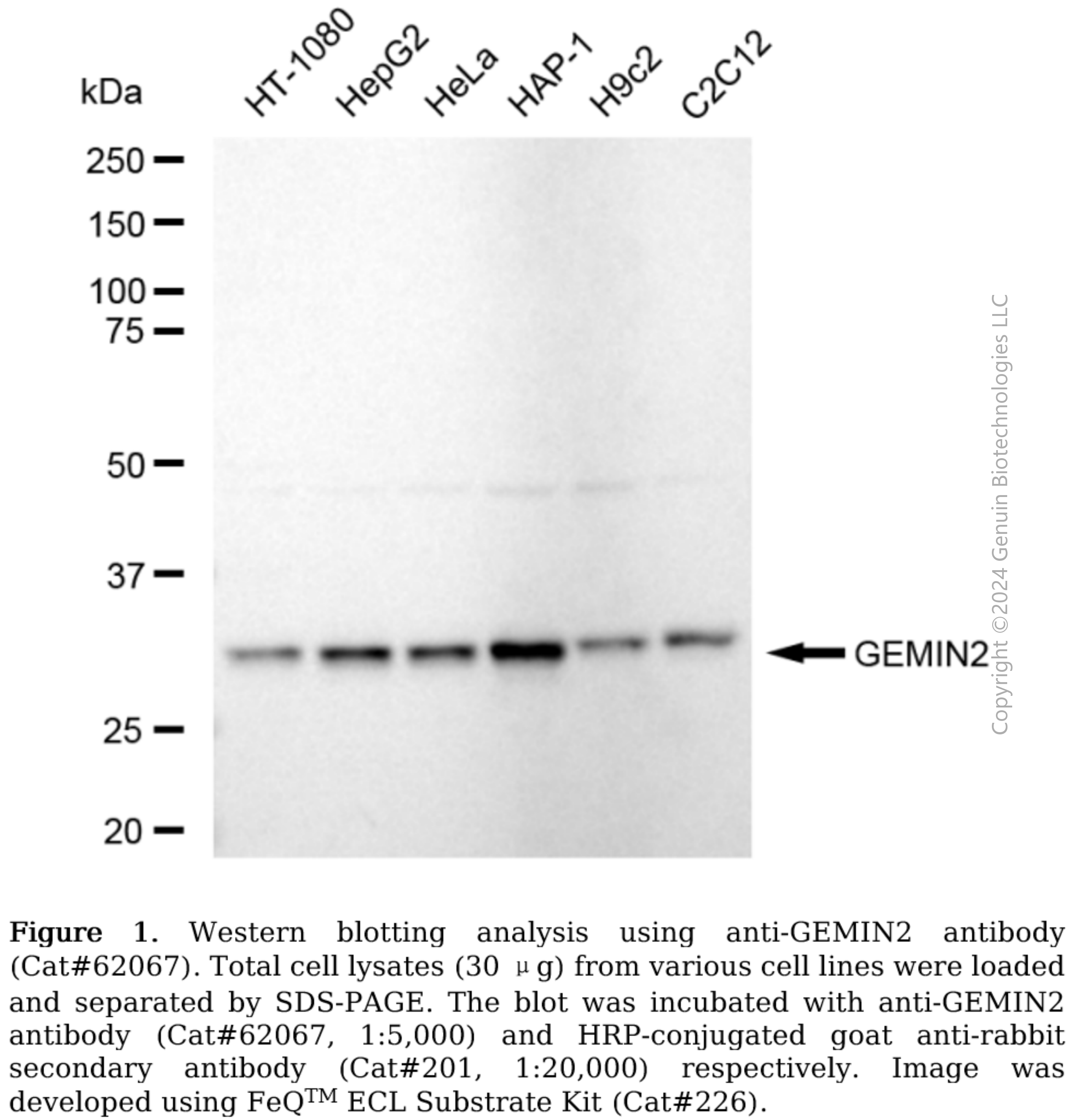 KD-Validated Anti-GEMIN2 Rabbit Monoclonal Antibody#62067