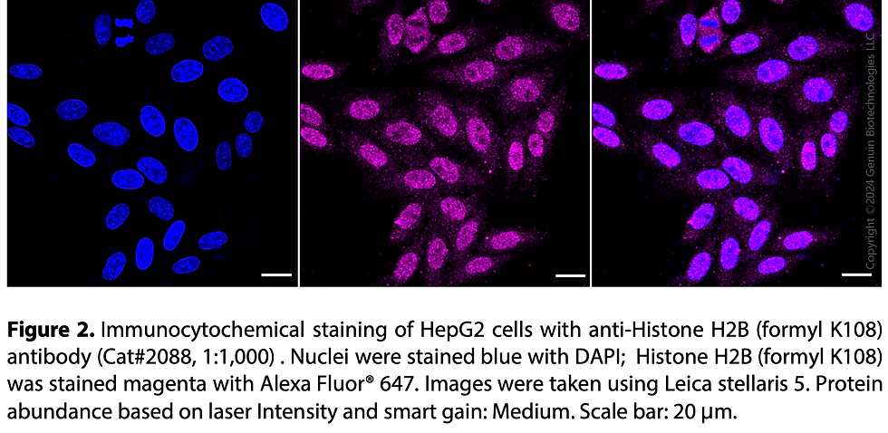 Thumbnail: Anti-Histone H2B (Formyl K108) Rabbit mAb #2088