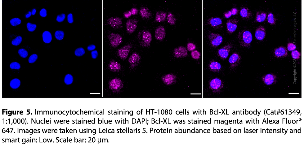 Thumbnail: KD-Validated Anti-Bcl-XL Rabbit Monoclonal Ab#61349