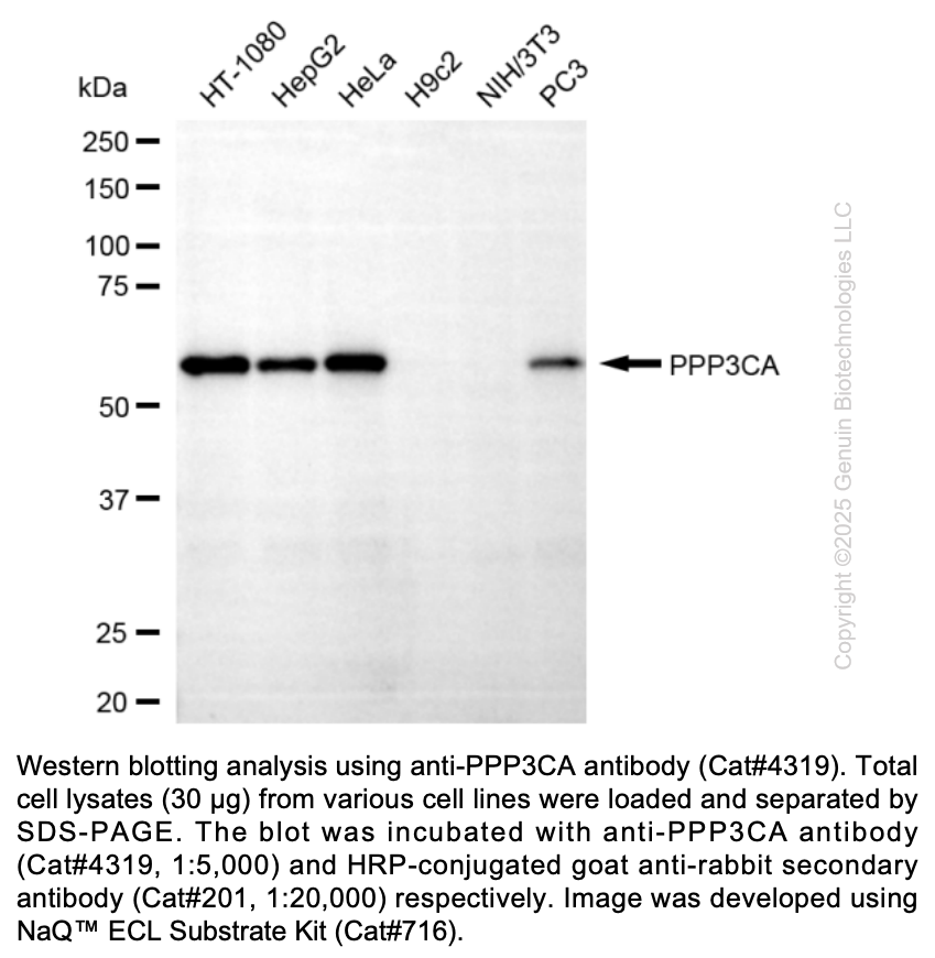 Anti-PPP3CA Rabbit Monoclonal Ab #4319