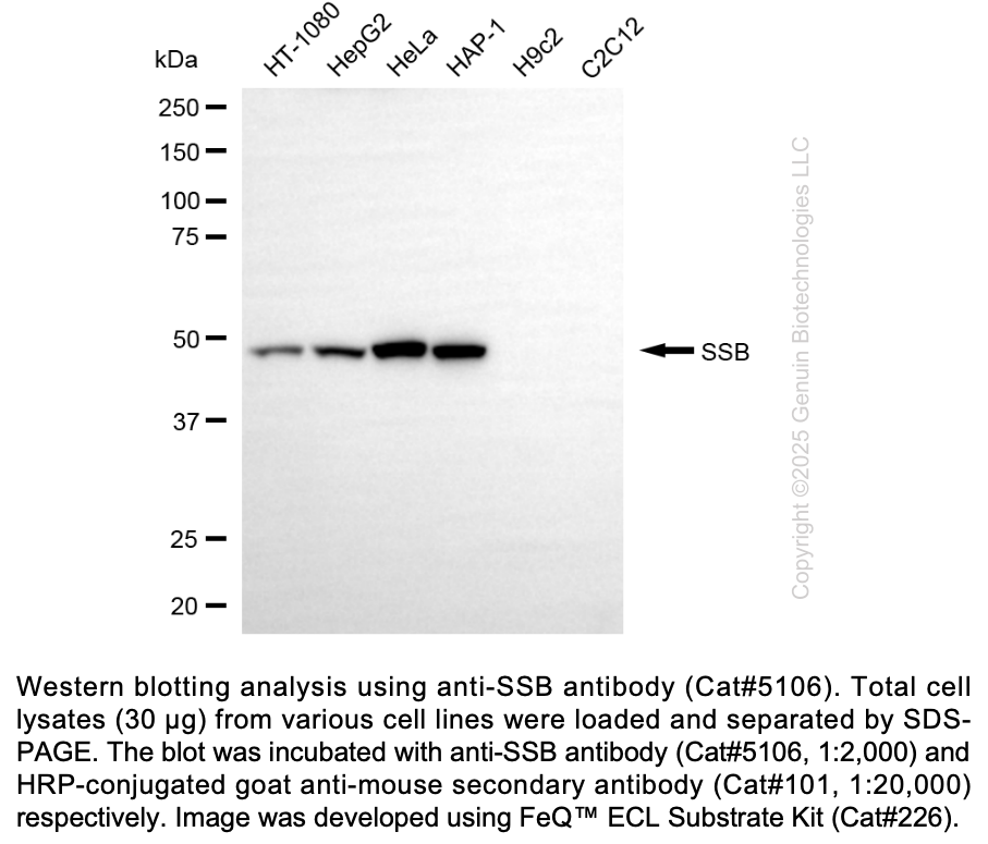 Anti-SSB Mouse Monoclonal Ab #5106