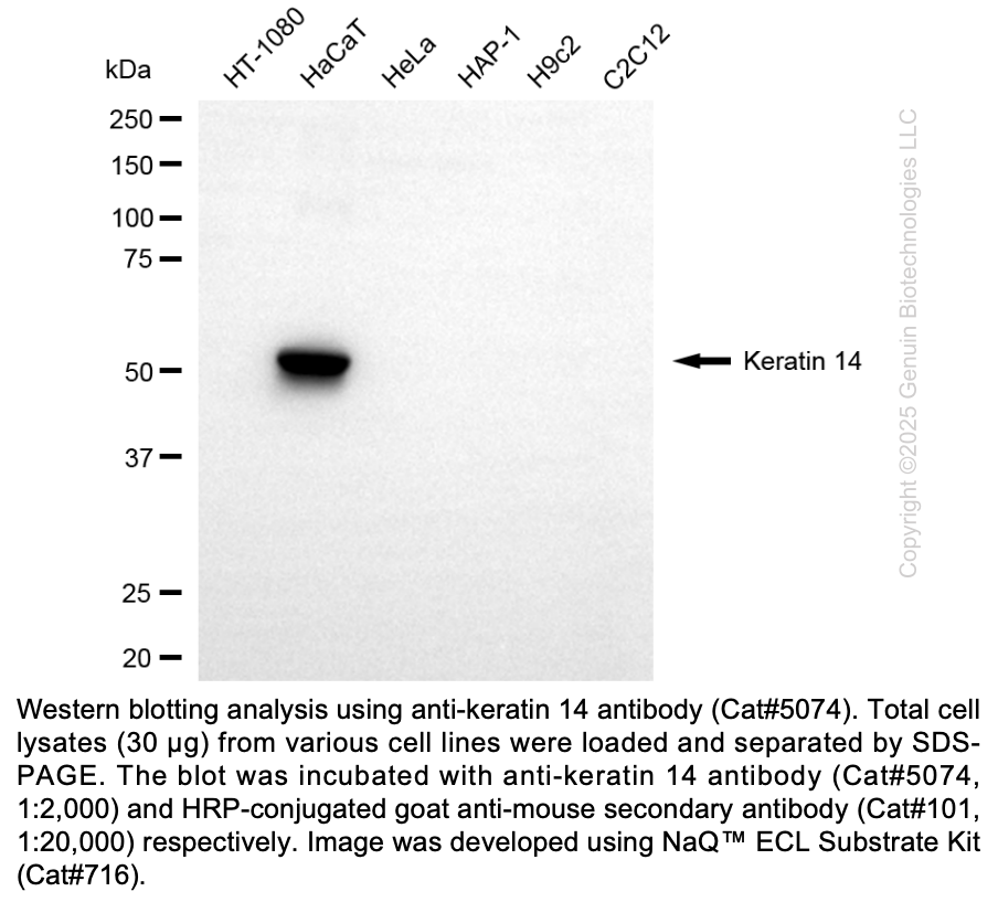 Anti-KRT14 Mouse Monoclonal Ab #5074