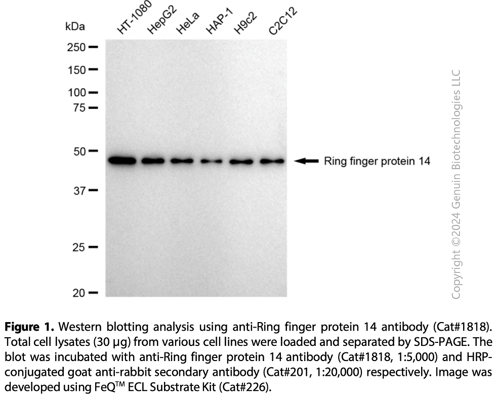 Thumbnail: Anti-Ring Finger Protein 14 Rabbit mAb #1818