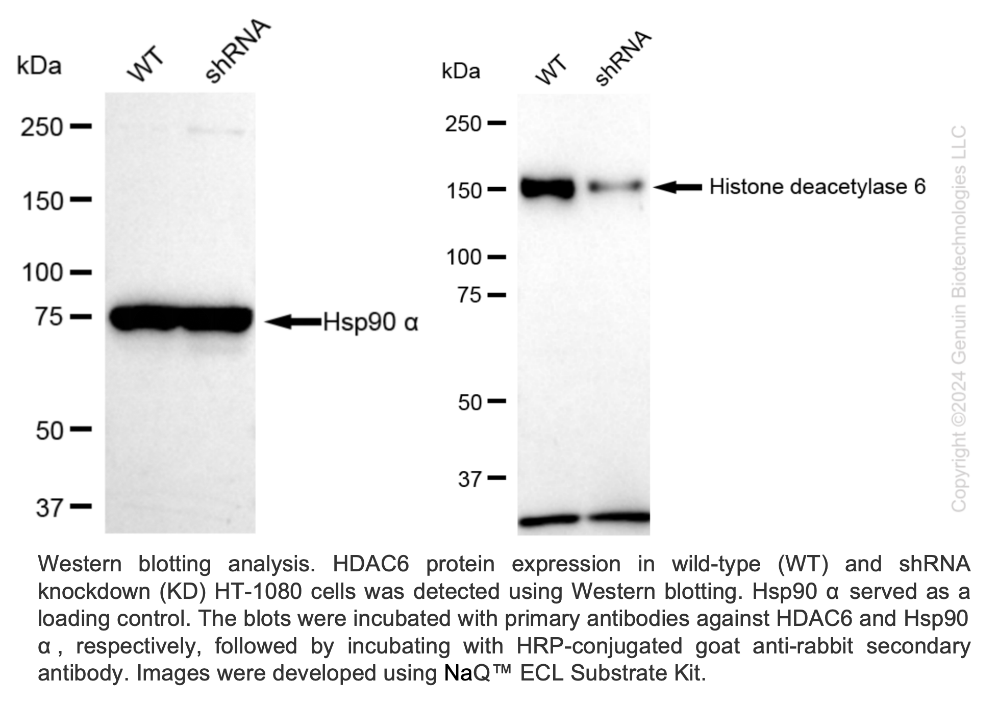 WB-Validated HDAC6 Lentiviral shRNA Knockdown Kit #V62136