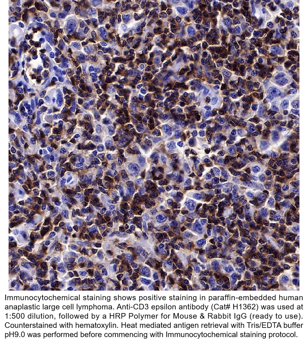 Thumbnail: Anti-CD3 epsilon Mouse Monoclonal Ab #H1362