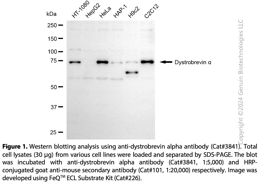 Thumbnail: Anti-DTNA Mouse Monoclonal Ab #3841