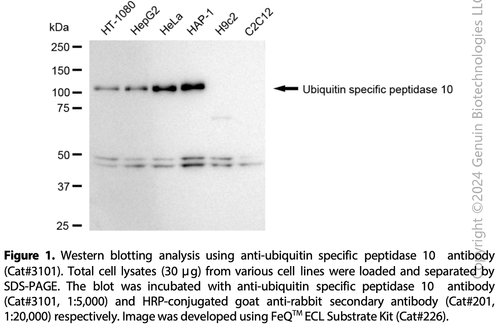 Anti-Ubiquitin Specific Peptidase 10 Rabbit mAb #3101