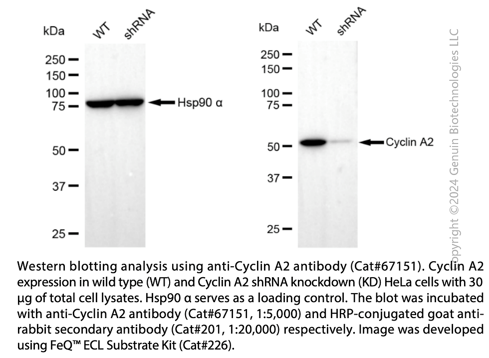 Thumbnail: KD-Validated Anti-Cyclin A2 Rabbit Monoclonal Ab#67151