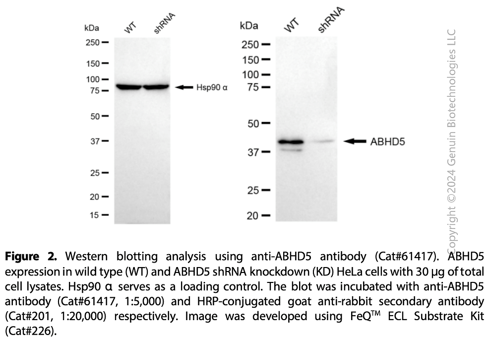 Thumbnail: KD-Validated Anti-ABHD5 Rabbit mAb#61417