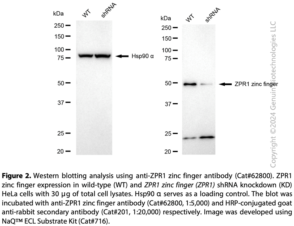 Thumbnail: KD-Validated Anti-ZPR1 Zinc Finger Rabbit Monoclonal Ab#62800