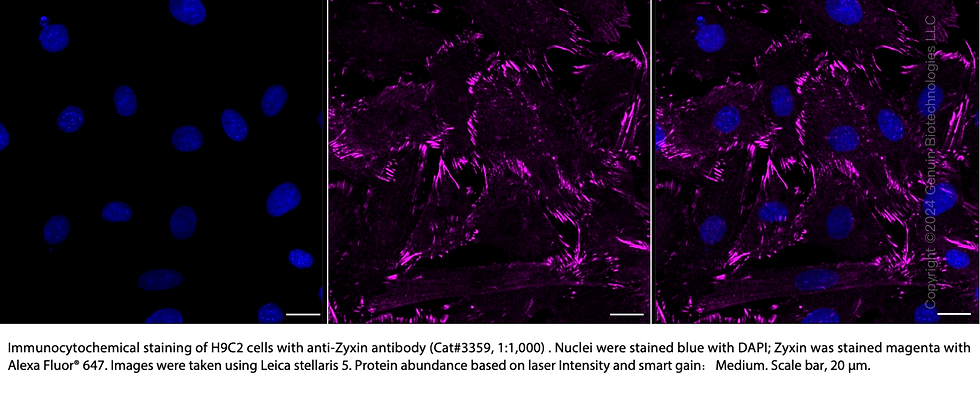 Thumbnail: Anti-Zyxin Rabbit mAb #3359