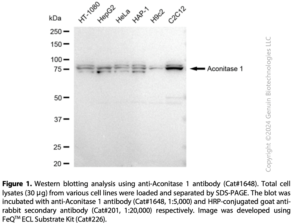 Thumbnail: Anti-Aconitase 1 Rabbit mAb #1648