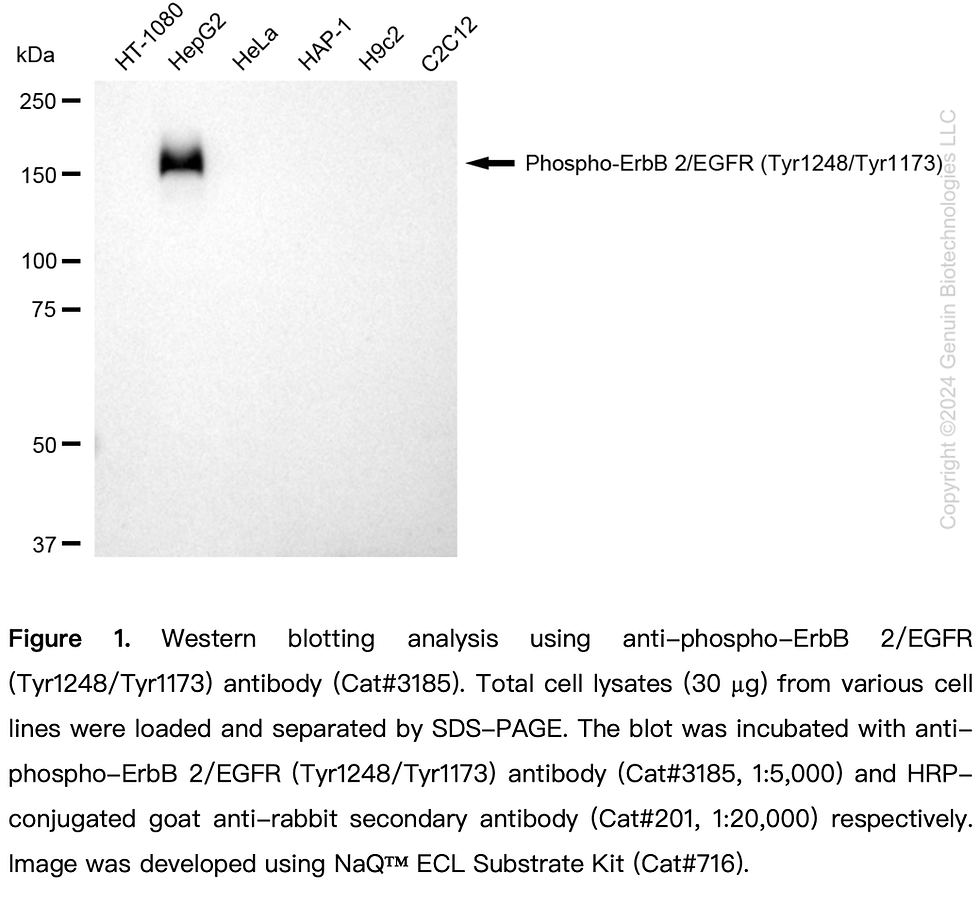Anti-Phospho-ErbB 2/EGFR (Tyr1248/Tyr1173) Rabbit Monoclonal Ab#3185