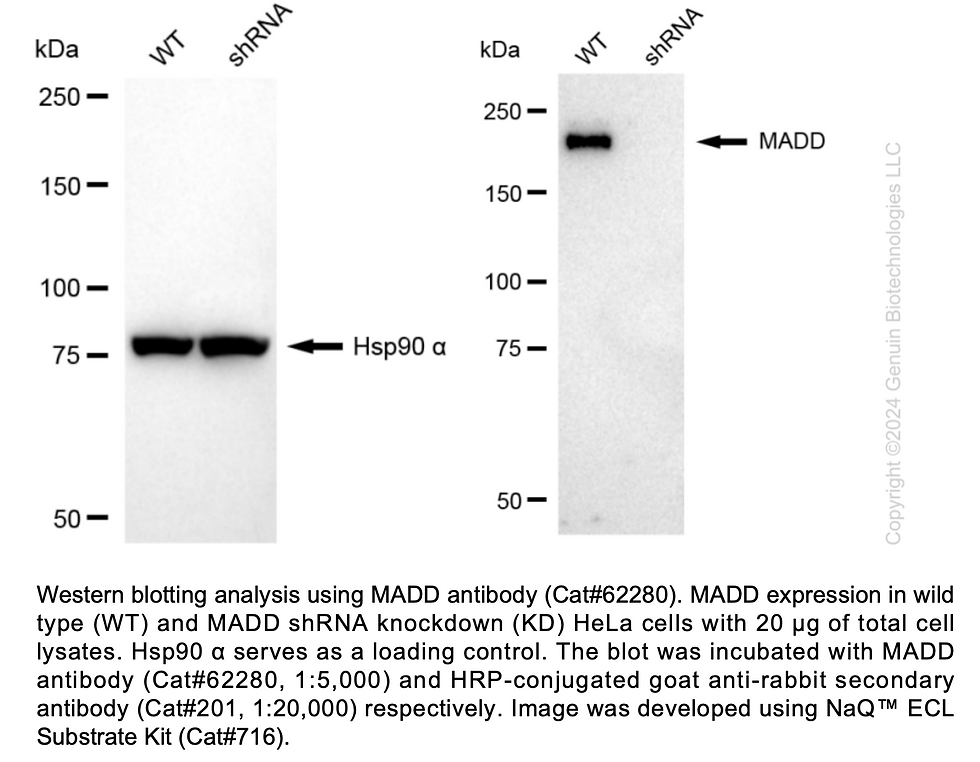 Thumbnail: KD-Validated Anti-MAP Kinase Activating Death Domain Rabbit Monoclonal Ab#62280