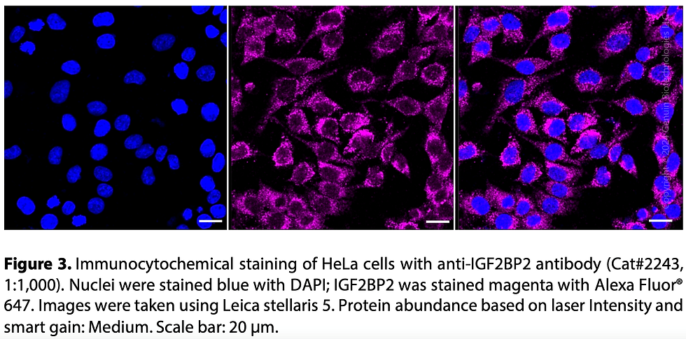 Thumbnail: Anti-IGF2BP2 Rabbit mAb #2243