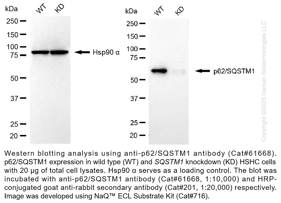 Thumbnail: KD-Validated Anti-Sequestosome 1 Rabbit Monoclonal Ab #61668
