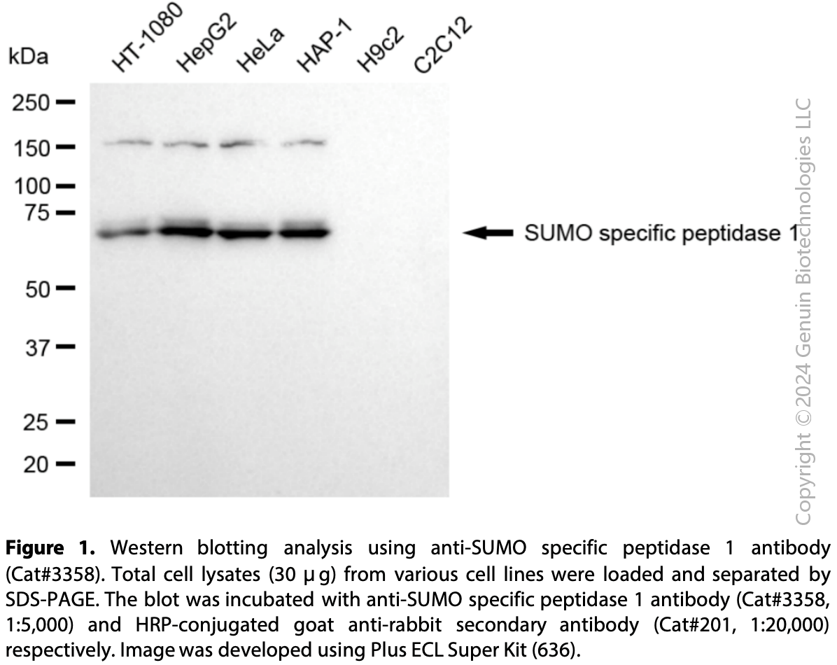 Anti-SUMO Specific Peptidase 1 Rabbit mAb #3358