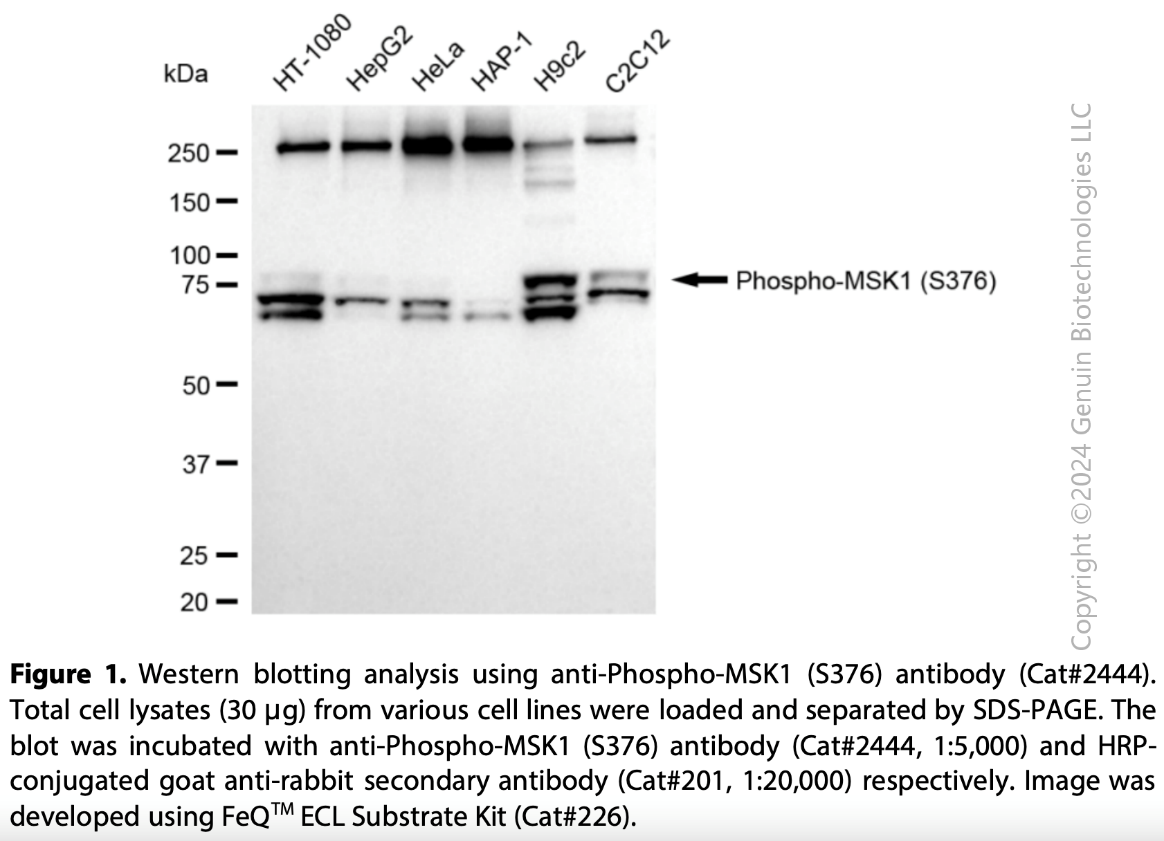 Anti-Phospho-MSK1 (S376) Rabbit mAb #2444