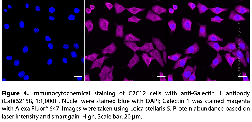 Thumbnail: KD-Validated Anti-Galectin 1 Rabbit mAb#62158