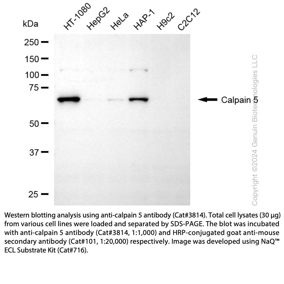 Anti-CAPN5 Mouse Monoclonal Ab #3814
