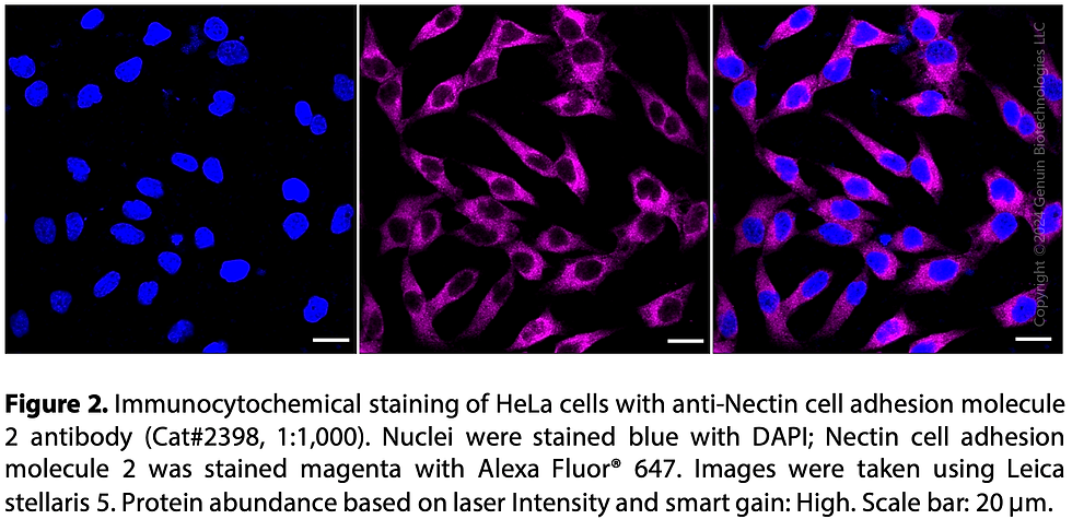 Thumbnail: Anti-Nectin Cell Adhesion Molecule 2 Rabbit mAb #2398