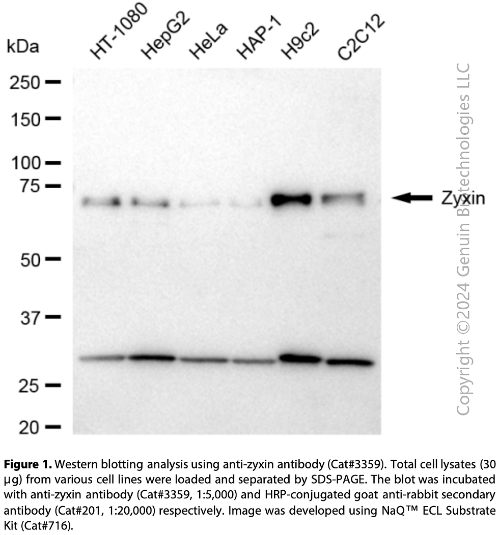 Thumbnail: Anti-Zyxin Rabbit mAb #3359