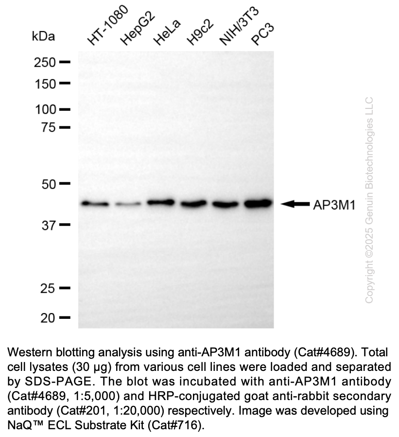 Anti-AP3M1 Rabbit Monoclonal Ab #4689