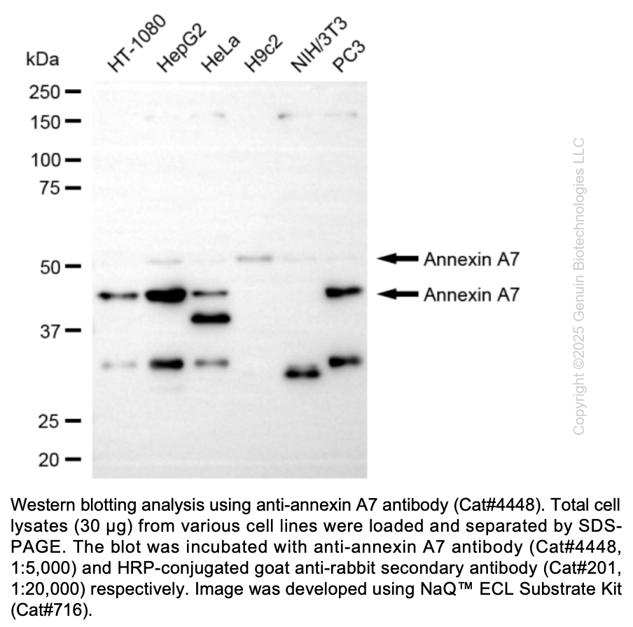 Anti-Annexin A7 Rabbit Monoclonal Ab #4448