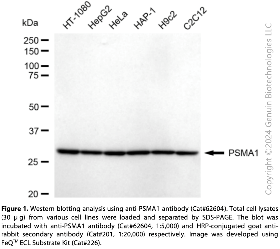 Thumbnail: KD-Validated Anti-PSMA1 Rabbit Monoclonal Ab#62604