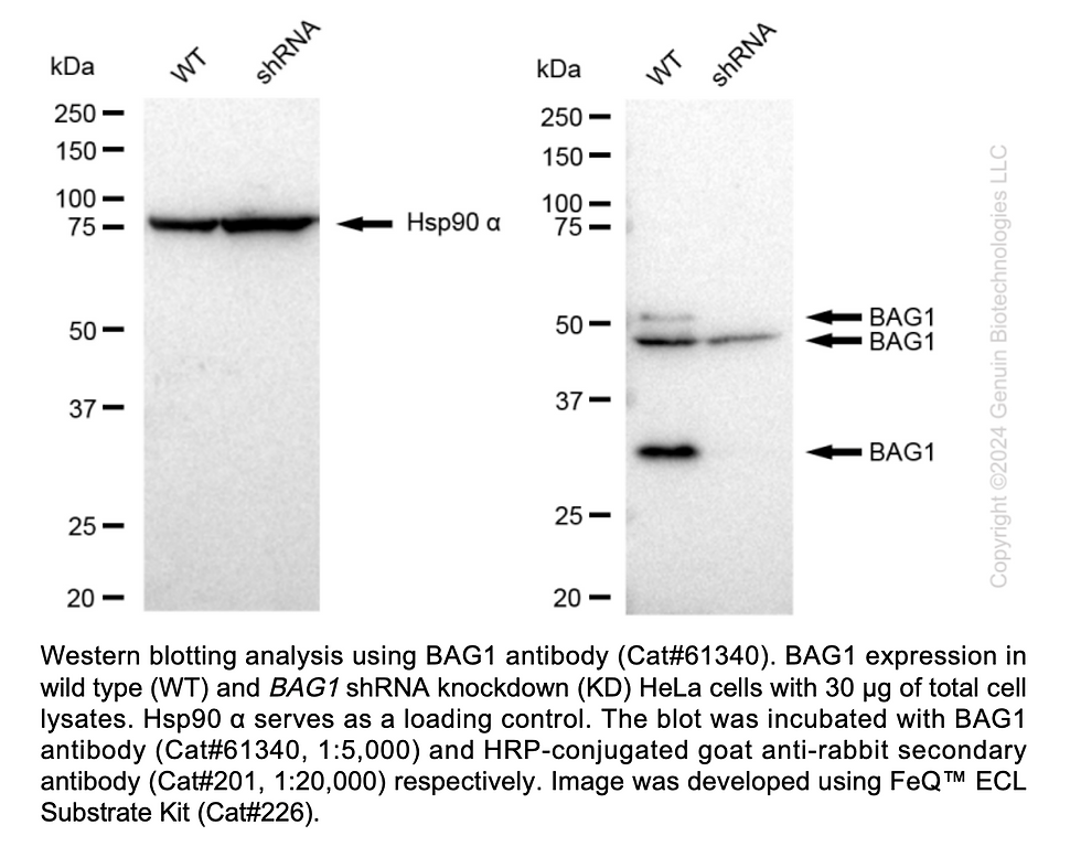 Thumbnail: KD-Validated Anti-BAG1 Rabbit mAb #61340