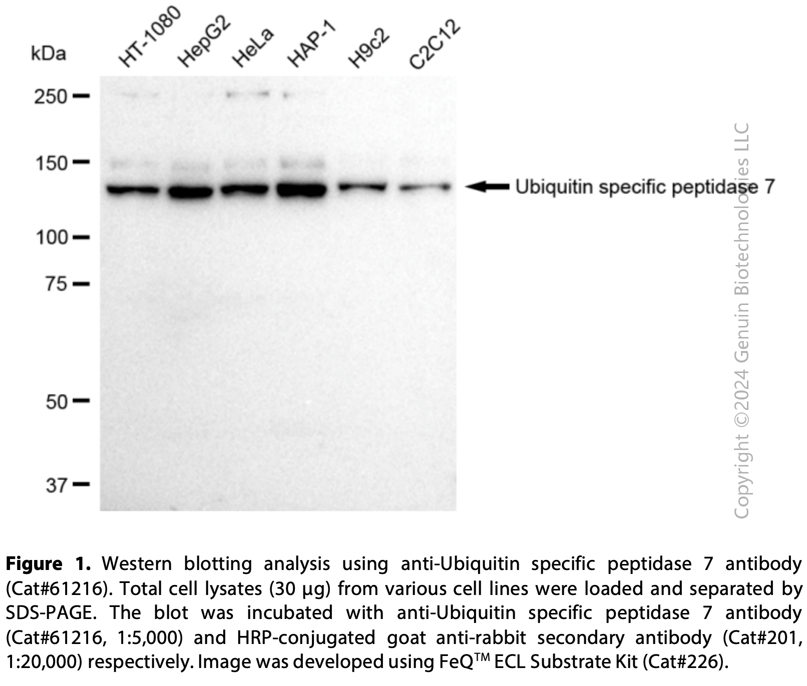 KD-Validated Anti-Ubiquitin Specific Peptidase 7 Rabbit mAb #61216
