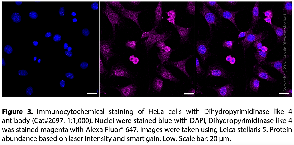 Thumbnail: Anti-Dihydropyrimidinase like 4 Rabbit mAb #2697